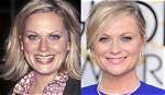 Amy Poehler Plastic Surgery Before and After Botox Injections |