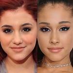 Ariana Grande's Eye Surgery and Its Profound Implications