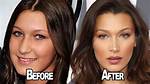 Bella Hadid: a Transformation Through Plastic Surgery