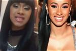 Cardi B’s New Teeth Costs $40K – Before and After Pictures of Smile Makeover | Dr. Catrise Austin Is the Dentist