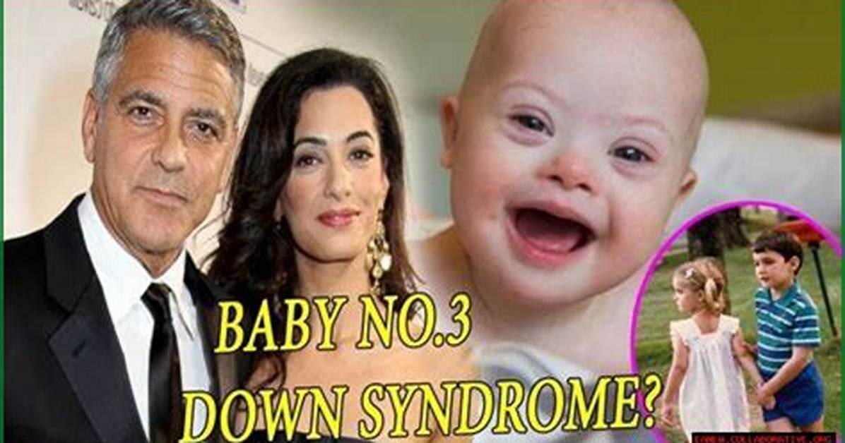 Celebrities and Down Syndrome: George Clooney's Connection