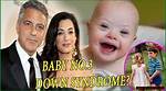 Celebrities and Down Syndrome: George Clooney's Connection