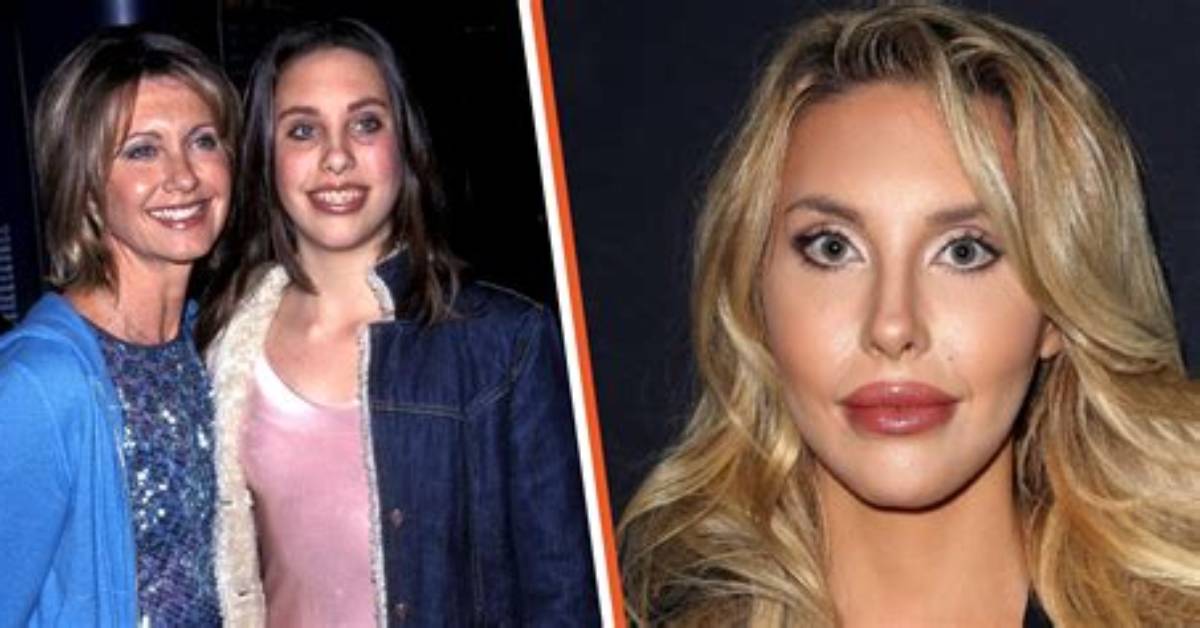 Chloe Lattanzi's Plastic Surgery Journey Explored