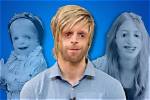 Courageous Faces: Celebrities with Treacher Collins Syndrome