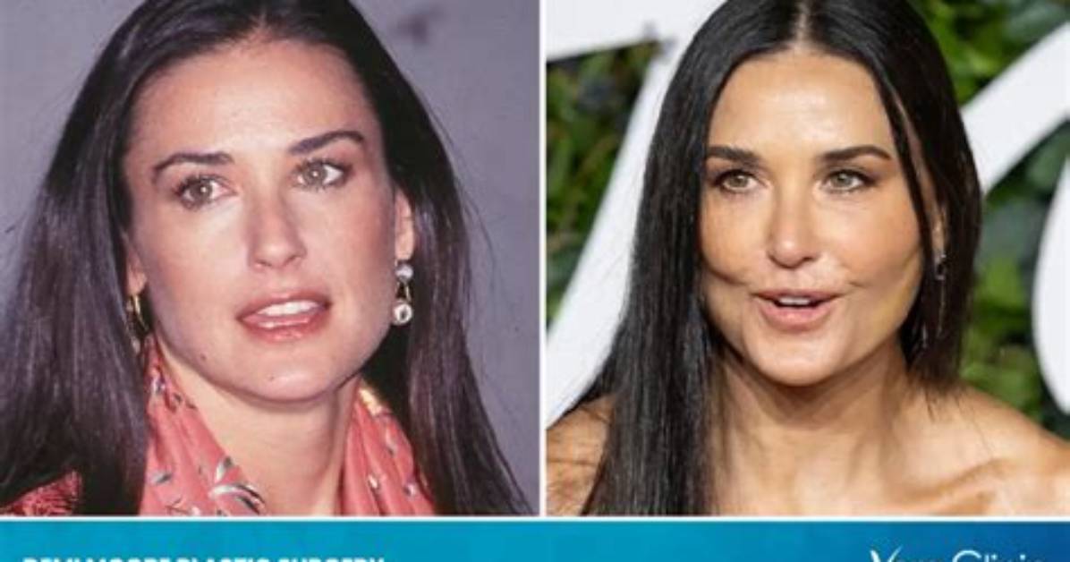 Demi Moore Spent a Fortune on Plastic Surgery