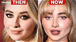 Did Sabrina Carpenter Undergo Plastic Surgery? Uncovering the Truth
