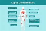 Discover the Impact of Ozempic on Lupus: an in-Depth Analysis