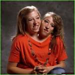 Exploring the Lives and Legacy of Abby and Brittany Hensel: Did They Die?