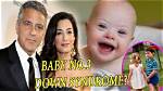 George Clooney's Son: Understanding Down Syndrome and Its Impact