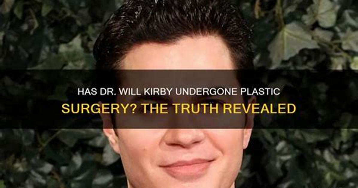 Has Dr. Will Kirby Had Plastic Surgery? Big Brother Fans Share Speculations! Fri 25 September 2 ·