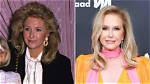 Has Rhobh Kathy Hilton Done Plastic Surgery? Fans Suspect Botox and Nose Job