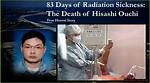Hisashi Ouchi's Journey: a Tale of Resilience and Survival