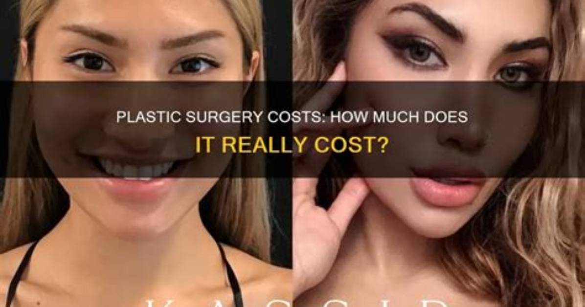 How Much Does the Plastic Surgeon and Rhony Star Make? |