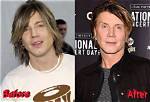 Johnny Rzeznik Plastic Surgery, Did Goo Goo Dolls Lead Singer John Rzeznik Had Plastic Surgery?