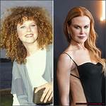 Kidman's Plastic Surgery Transformation: Before and After