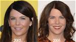Lauren Graham's Plastic Surgery Journey Explored