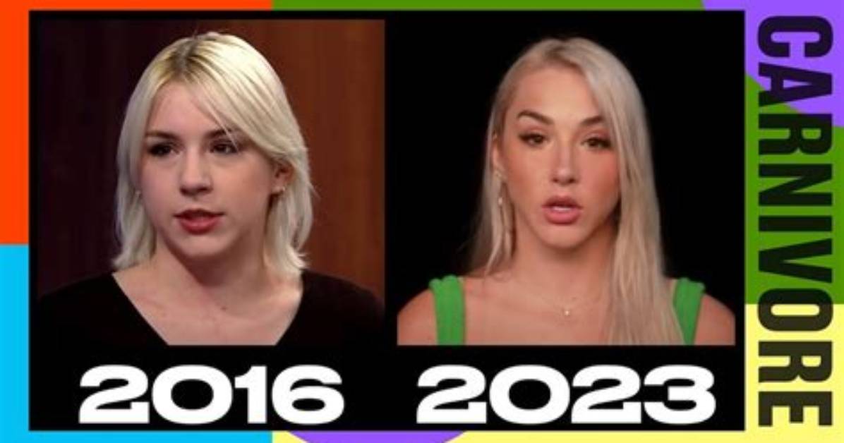 Mikhaila Peterson's Journey Before Plastic Surgery