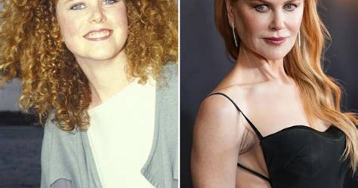 Nicole Kidman's Stunning Transformation: the Truth Behind Her Surgery