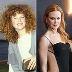 Nicole Kidman: the Plastic Evolution of a Timeless Star in 2024