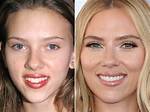 'No Nose Job and No Veneers' ·