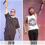 Post Malone Then and Now