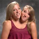 Remembering the Lives of Conjoined Twins Abby and Brittany