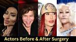 Shows off Recent Surgery Hollywood Life