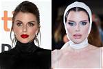 Sofia Richies Plastic Surgery Transformation: Before and After