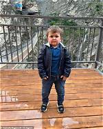 The Mystery of Hasbulla's Rare Medical Condition