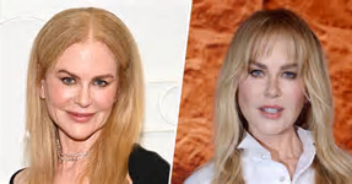 The Ultimate Guide to Nicole Kidman's Plastic Surgery Journey