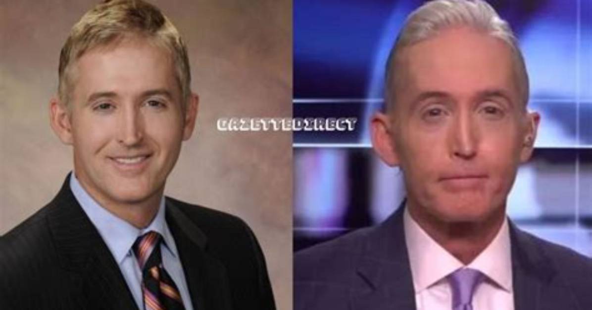 Trey Gowdy Nose Before and After: a Comprehensive Look at His Transformation