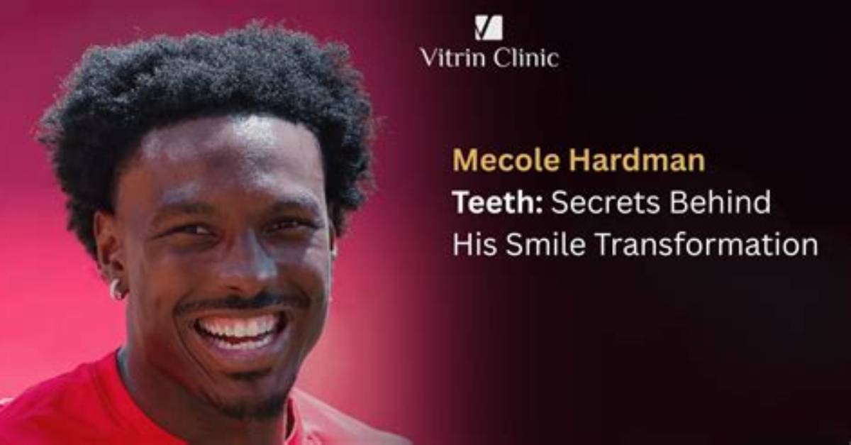 Uncover the Secrets of Mecole Hardman Sr.'s Nfl Success