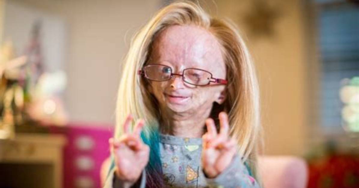 Understanding the Condition of Adalia Rose: a Journey of Resilience
