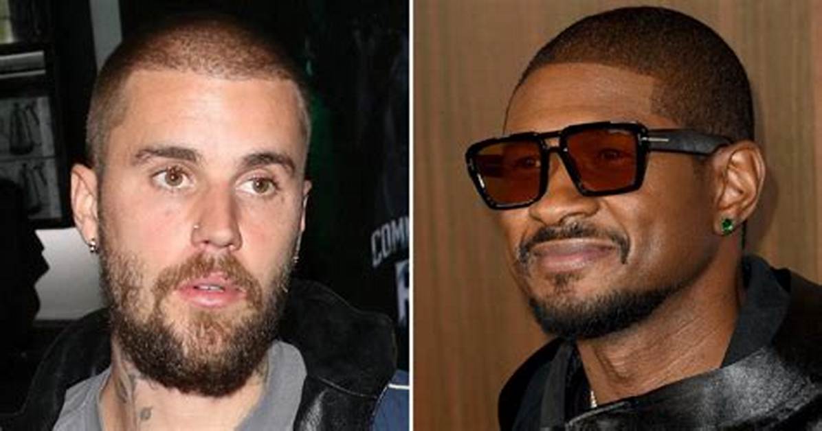 Unlocking the Secrets Behind Justin Bieber's Hair Transplantation Journey