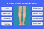 Unpacking the Mystery Behind the Knee Thing Picture