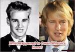 Unraveling the Mystery: What Happened to Owen Wilson's Nose?