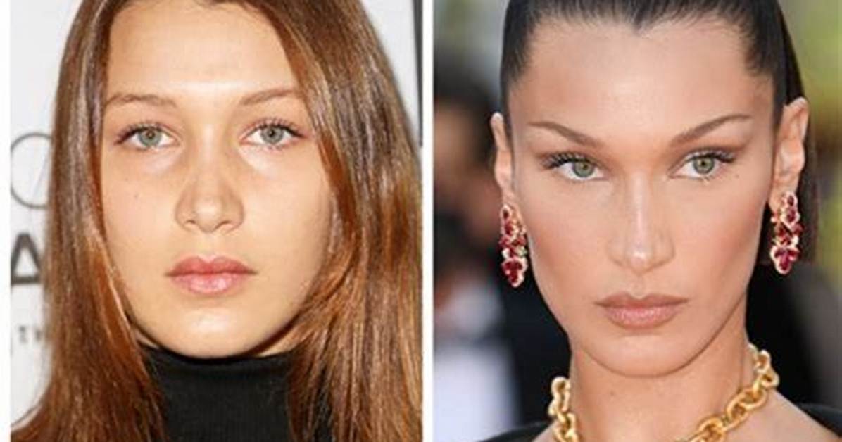 Unveiling Bella Hadid: a Glimpse Before Plastic Surgery