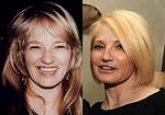 Unveiling Ellen Barkin's Plastic Surgery Journey: Discoveries and Transformations