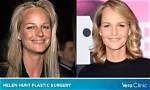 Unveiling the Journey of Helen Hunt (2001–2017)
