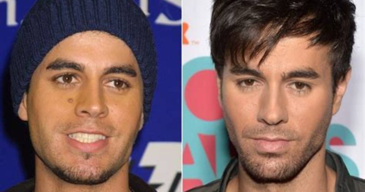 Unveiling the Secrets: Enrique Iglesias' Mole Explored