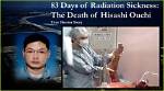 Unveiling the Tragic Tale: Hisashi Ouchi Picture After Radiation