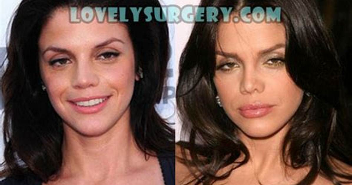 Vanessa Ferlito Plastic Surgery Before and After