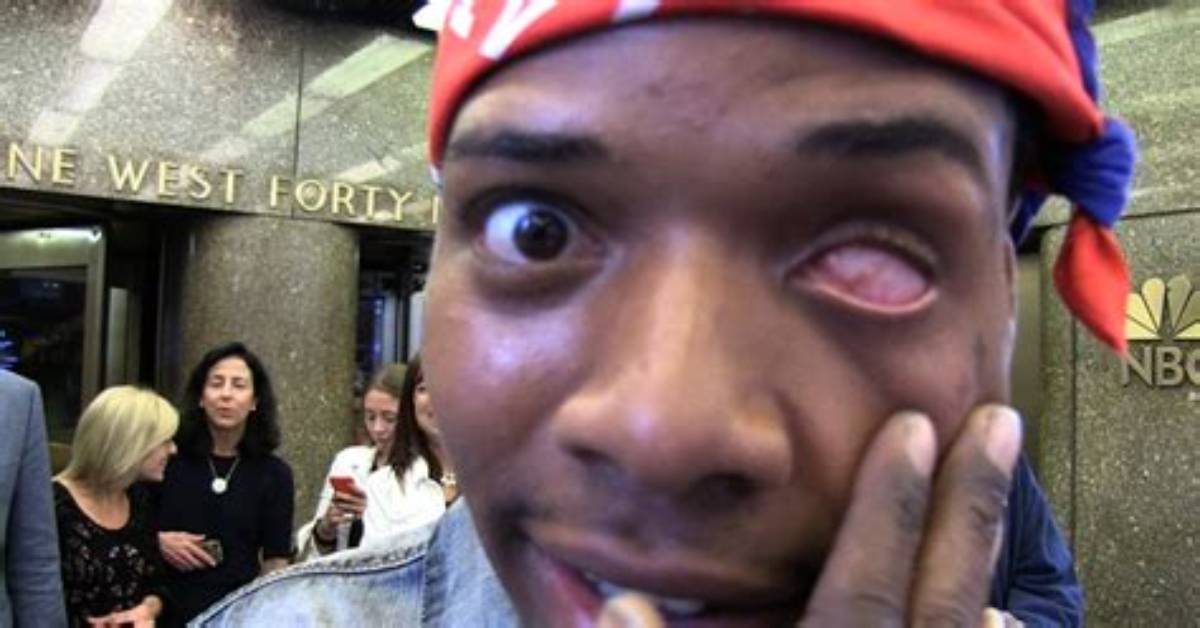 What Happened to Fetty Wap's Eye