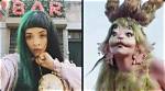 What Happened to Melanie Martinez Face? Plastic Surgery Botox and Nose Job |