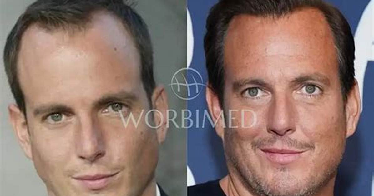 Will Arnett Weight Loss: Before and After Photos