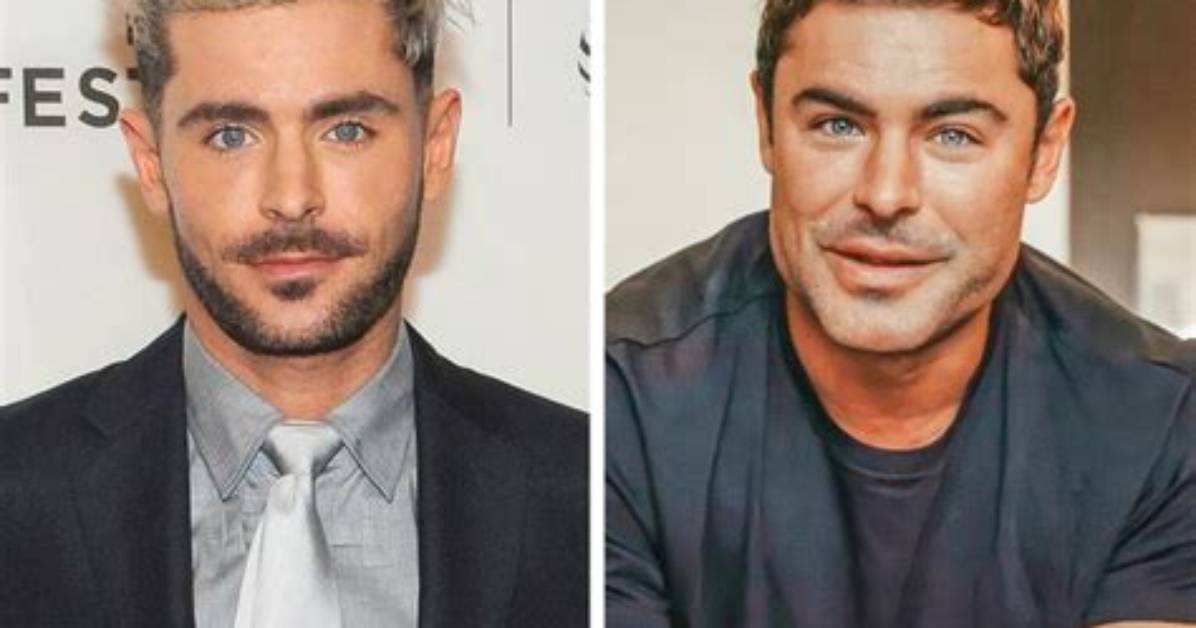 Zac Efron's Shocking Face Accident: Before and After